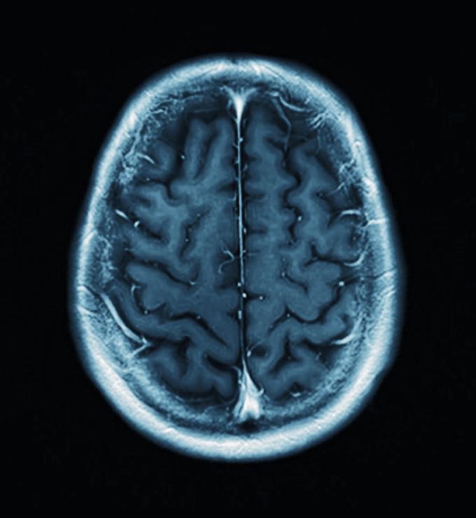 brain   image