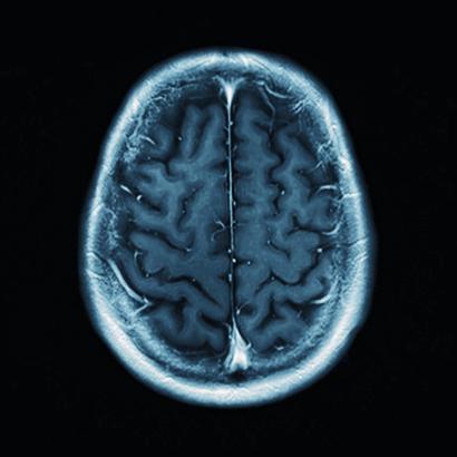 brain   image