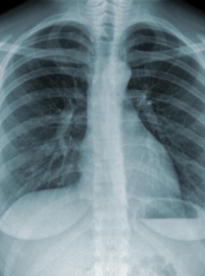 xray_shutterstock_80449837.jpg