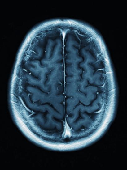 brain   image
