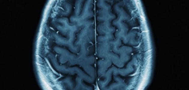brain   image