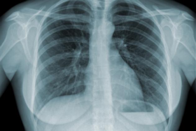 xray_shutterstock_80449837.jpg