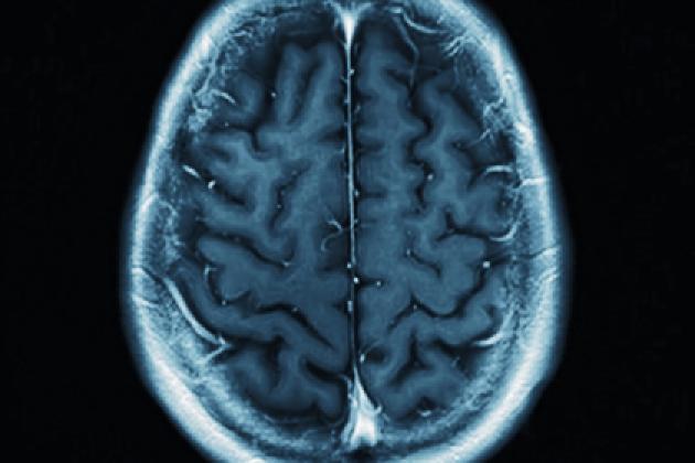 brain   image