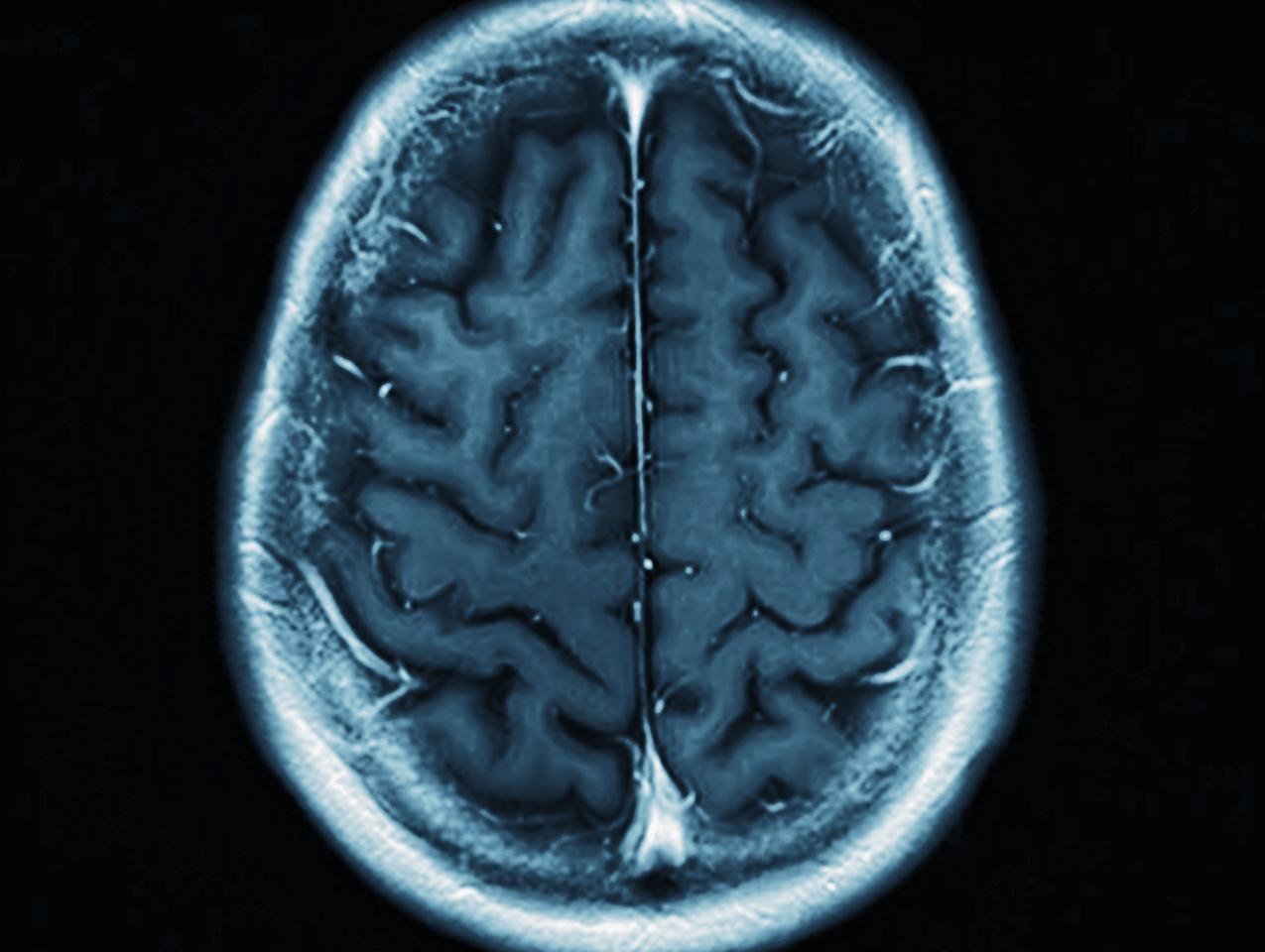 brain   image