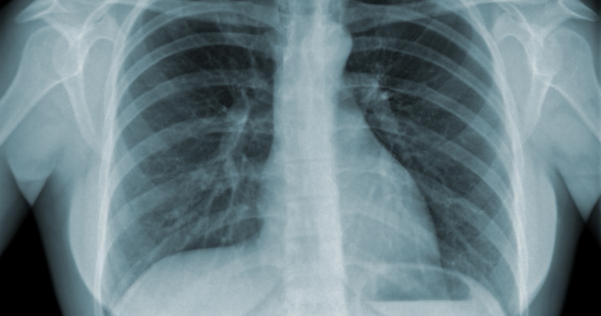 xray_shutterstock_80449837.jpg