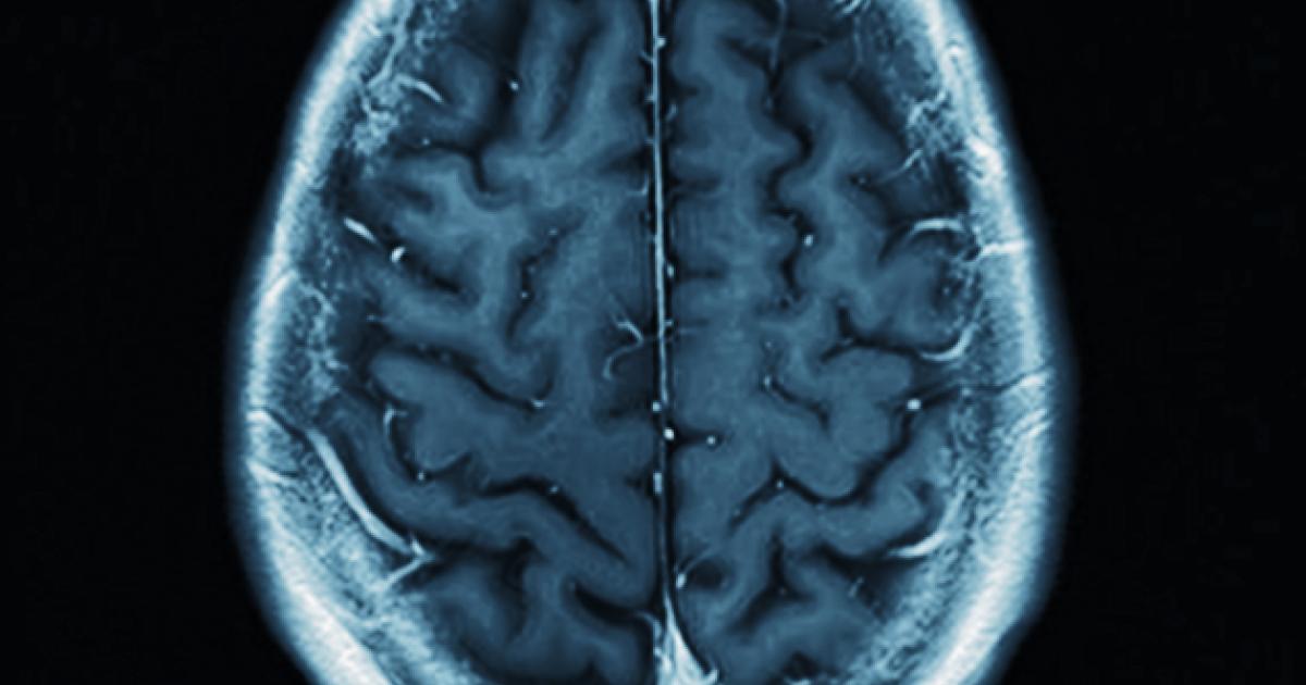 brain   image